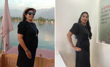 Patient transformation 1